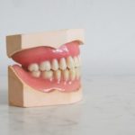 razones para reponer los dientes perdidos
